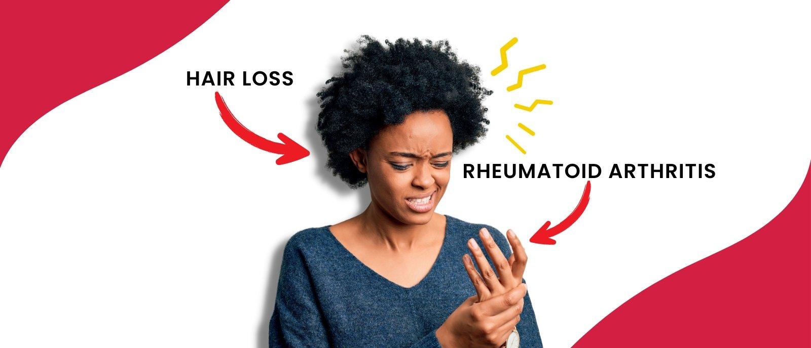 Link Between Rheumatoid Arthritis and Hair Loss