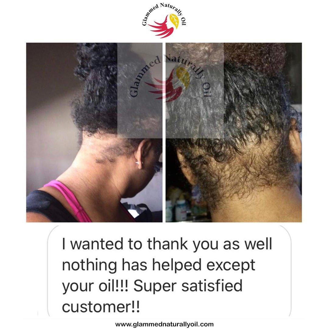 Dynamic Hair Growth & Moisture Bundle - GlammedNaturallyOil
