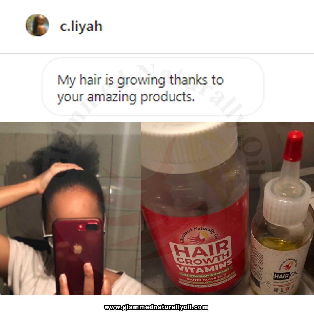 Dynamic Hair Growth & Moisture Bundle - GlammedNaturallyOil