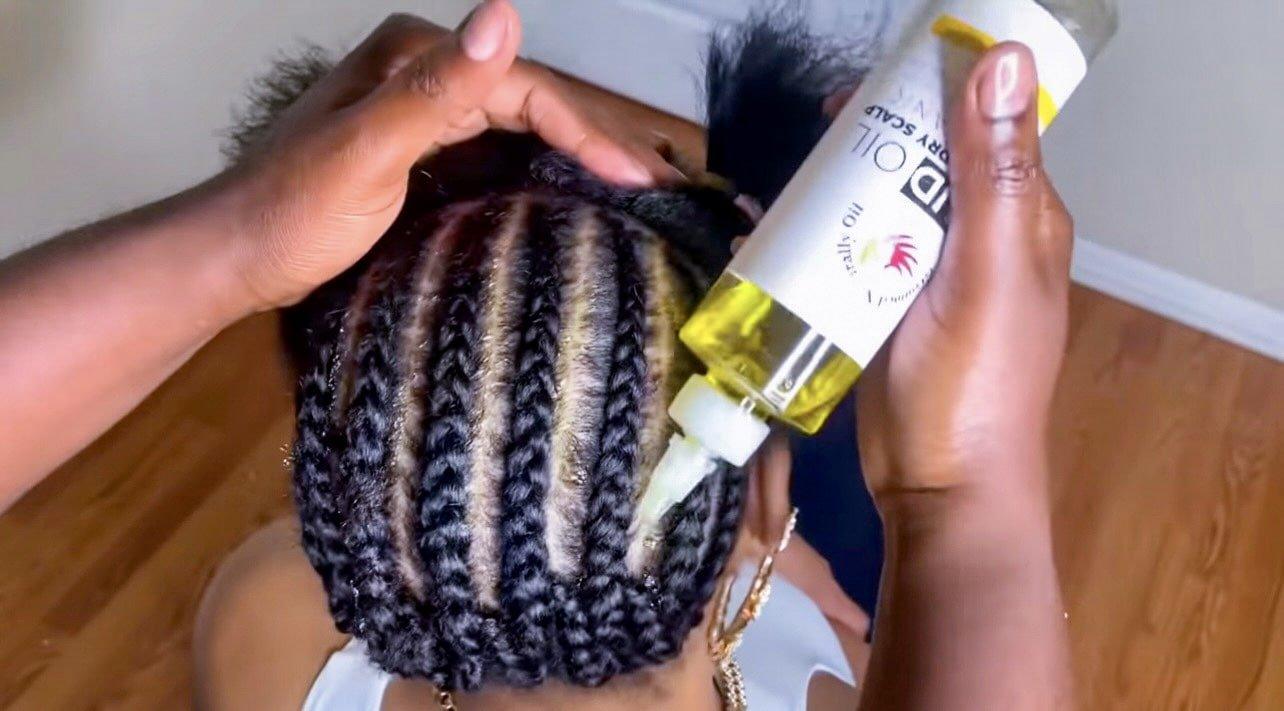 Itchy Scalp Bundle - GlammedNaturallyOil