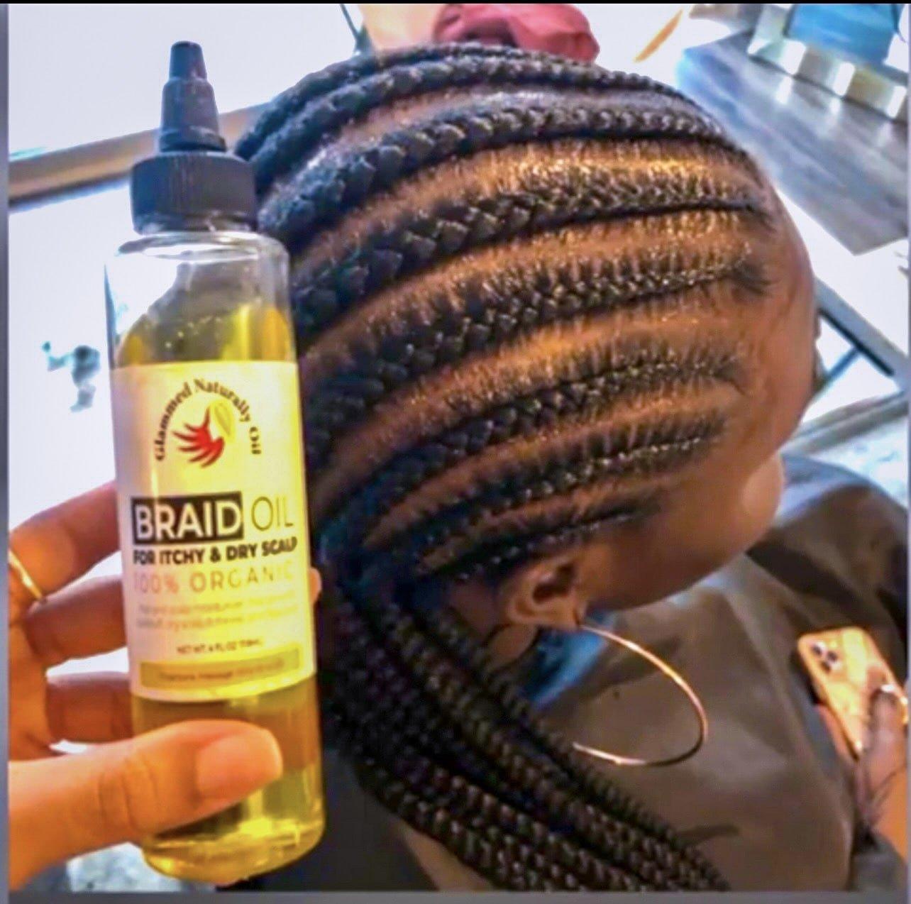 Itchy Scalp Bundle - GlammedNaturallyOil