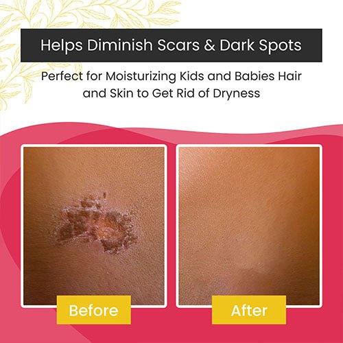 Kids Hair & Body Moisture combo (Mango Butter) - GlammedNaturallyOil