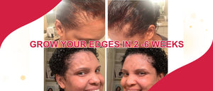 A Simple Trick To Grow Your Edges In 2 -6 Weeks