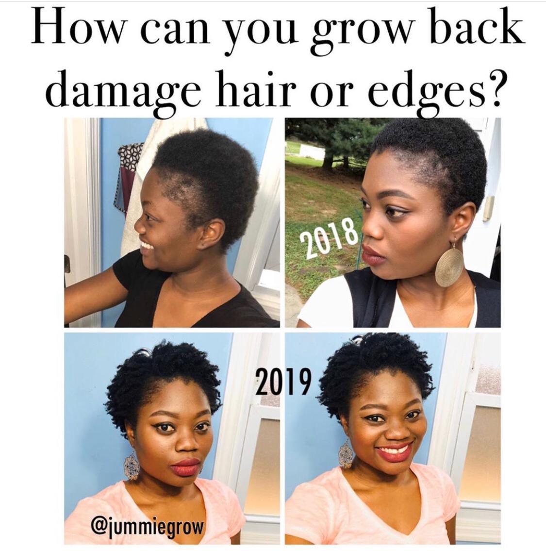 How GlammedNaturallyOil CEO JUMMIE grew back her edges - GlammedNaturallyOil