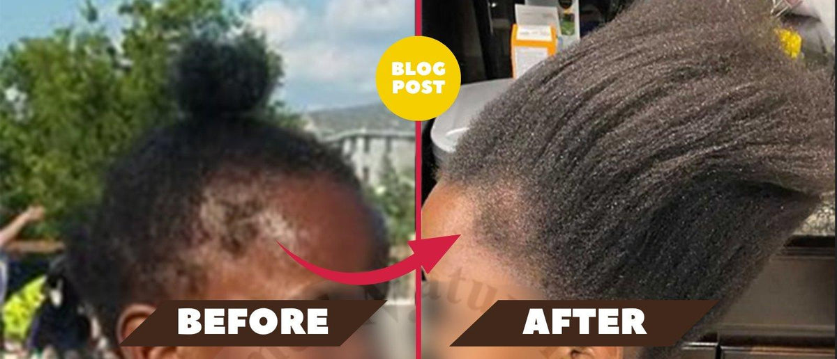 How To Promote Hair Growth And Prevent Hair Loss