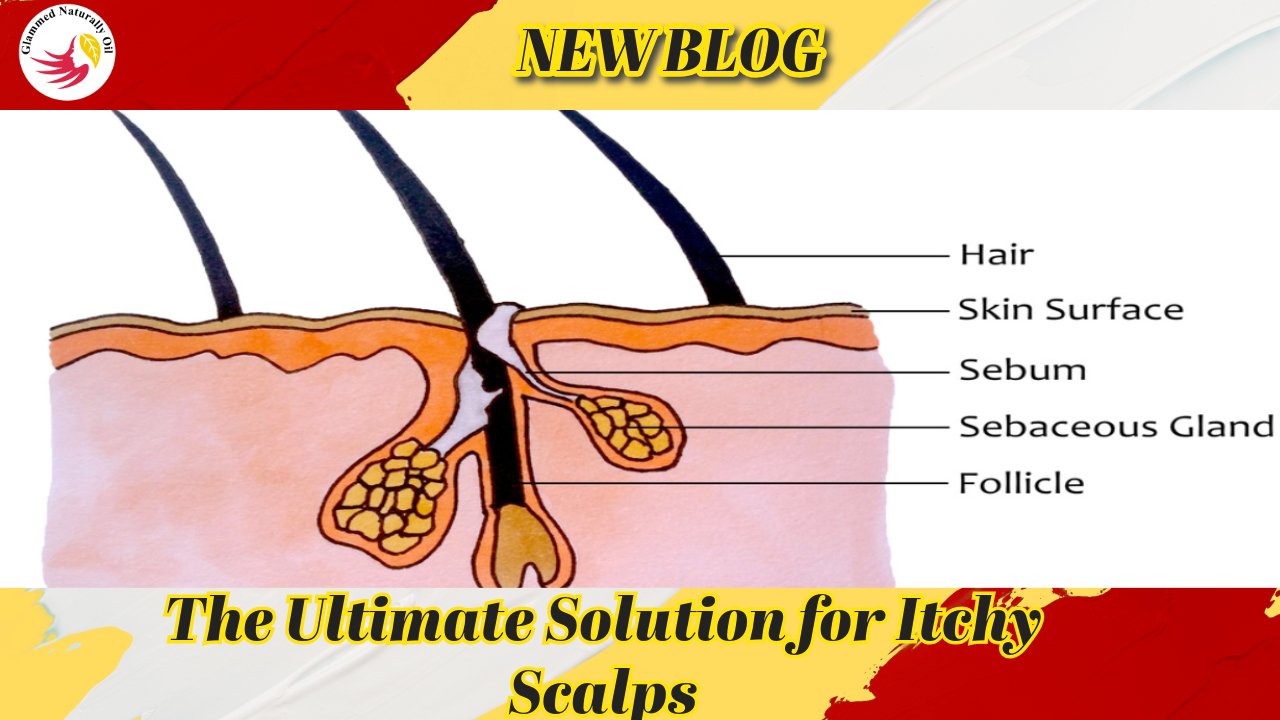 The Ultimate Solution for Itchy Scalps - GlammedNaturallyOil