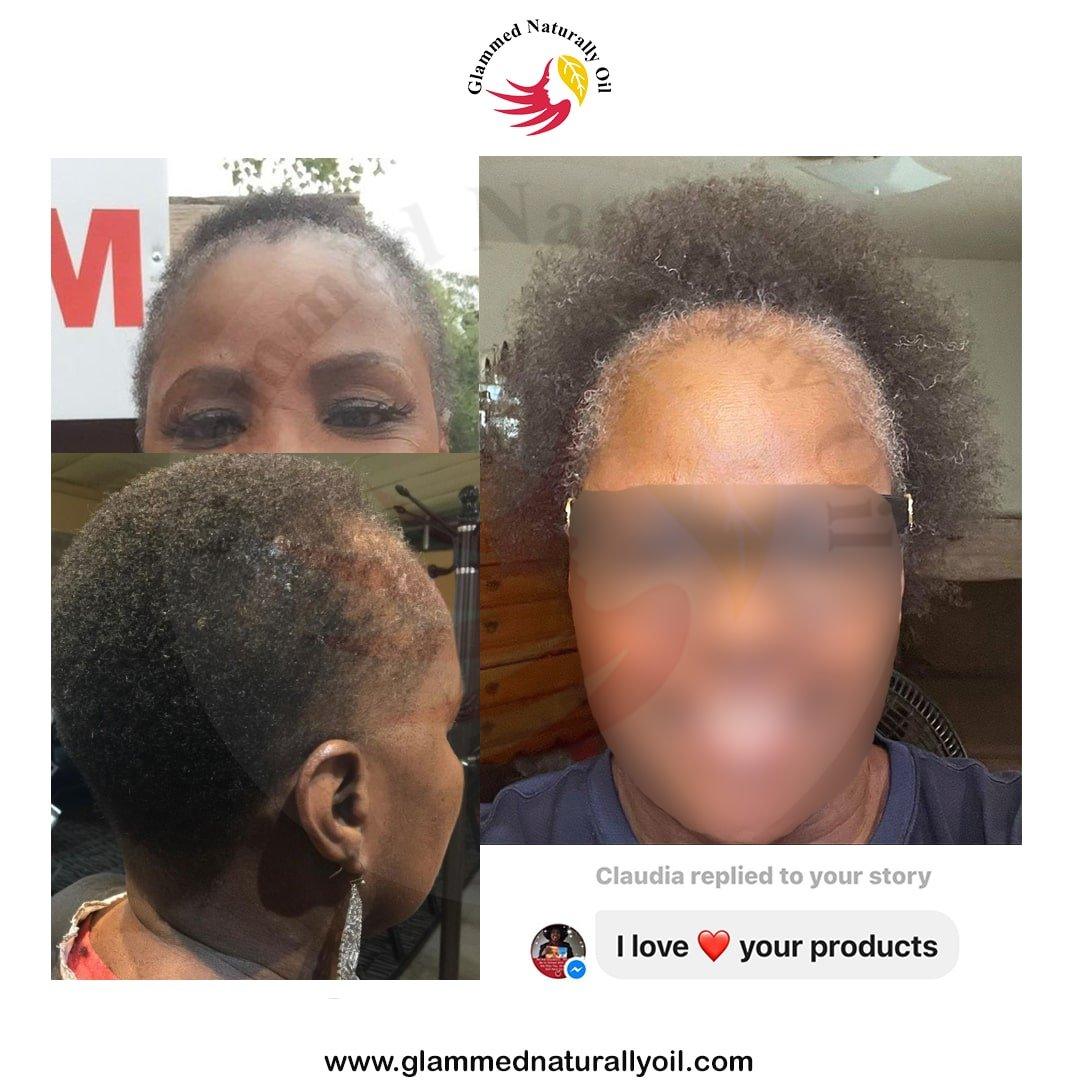 Double Hair Growth oil Bundle - GlammedNaturallyOil
