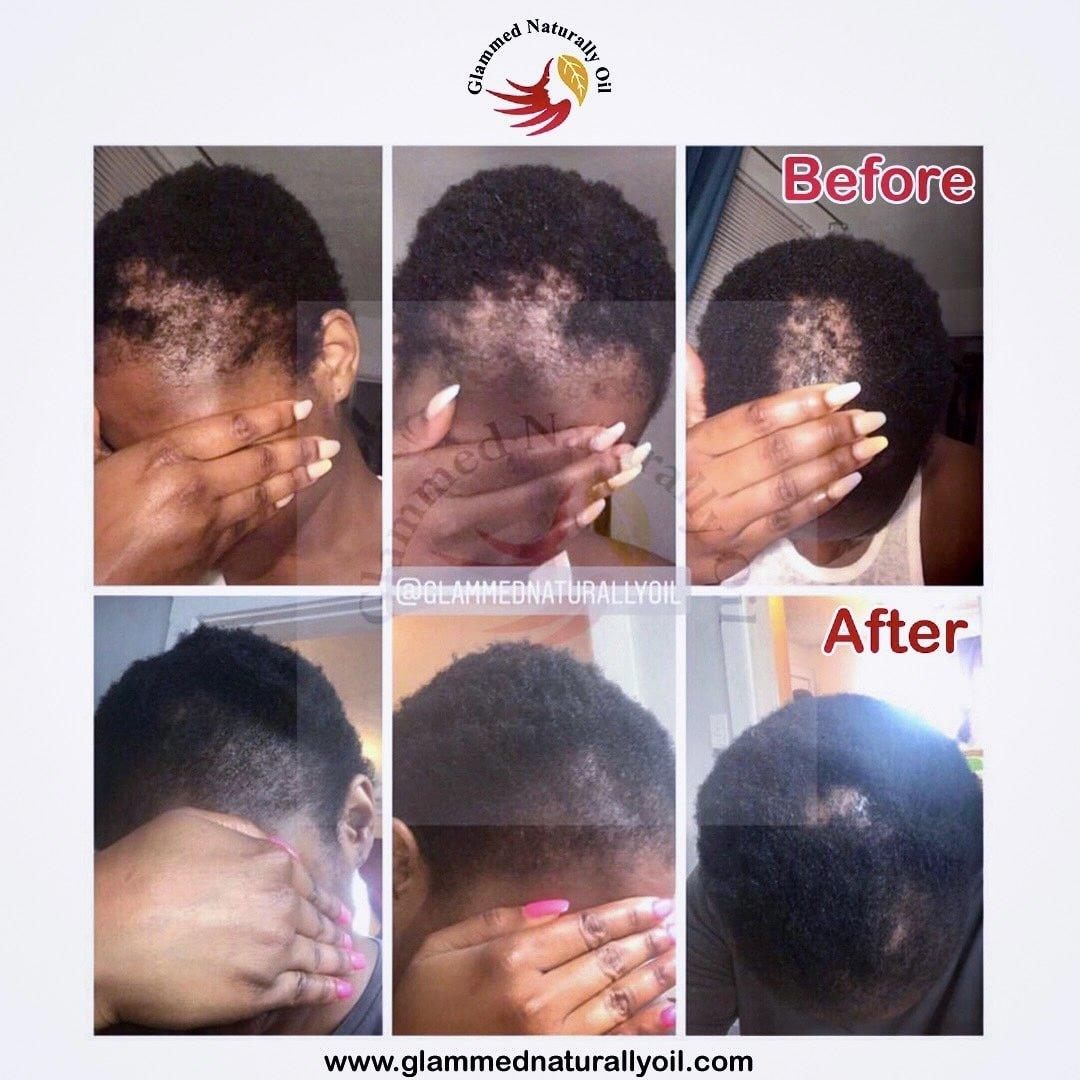 Everlasting Hair Growth & Moisture Bundle - GlammedNaturallyOil